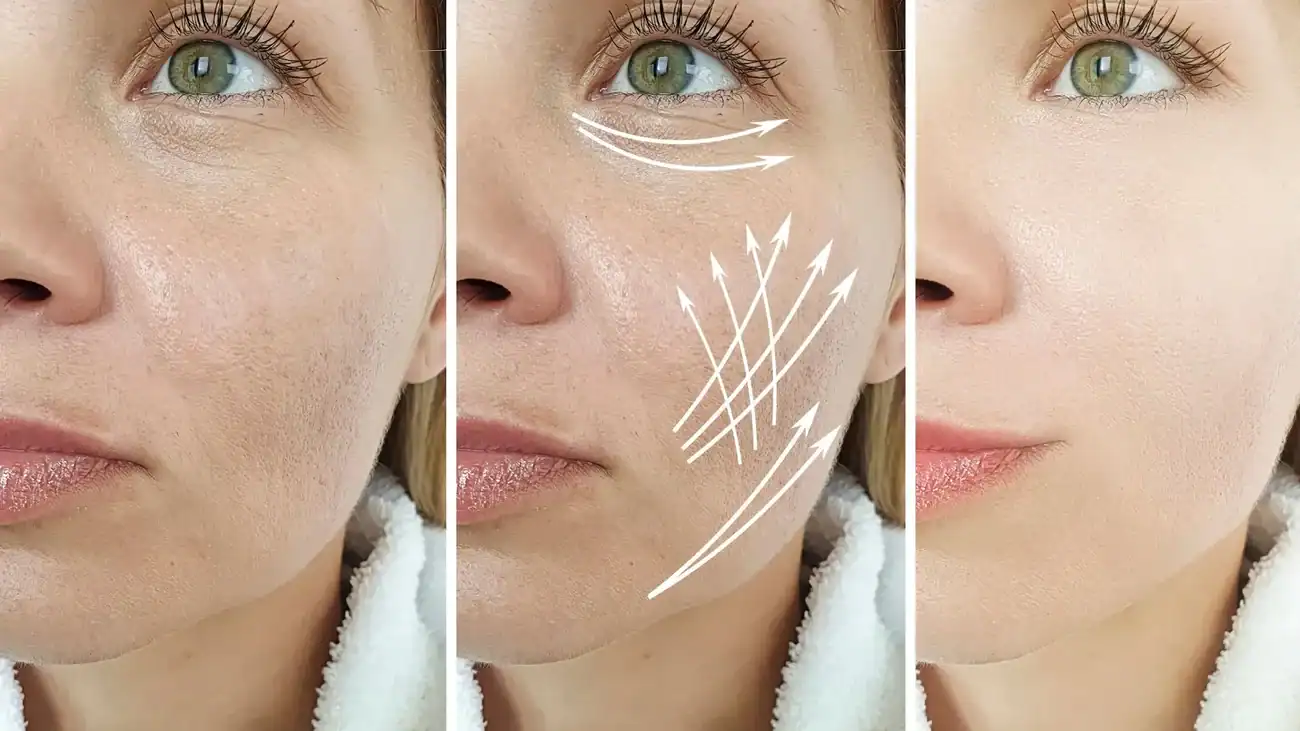Can One Treatment Really Tackle More Than One Skin Concern Datchet?