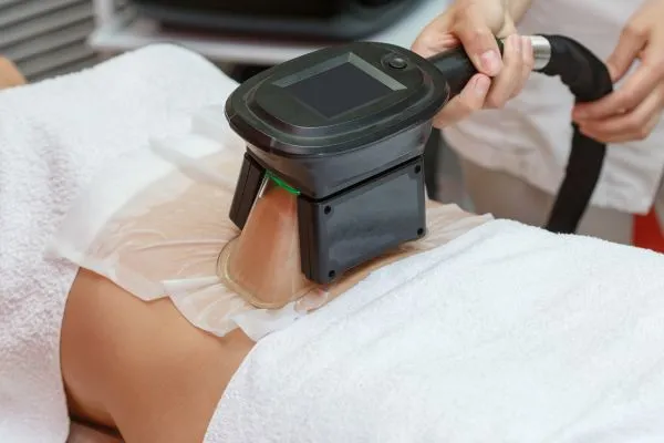 Image of person having fat freezing treatment to help weight gain Datchet