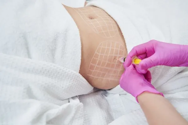 image of fat dissolving injections on love handles to help combat weight gain Datchet