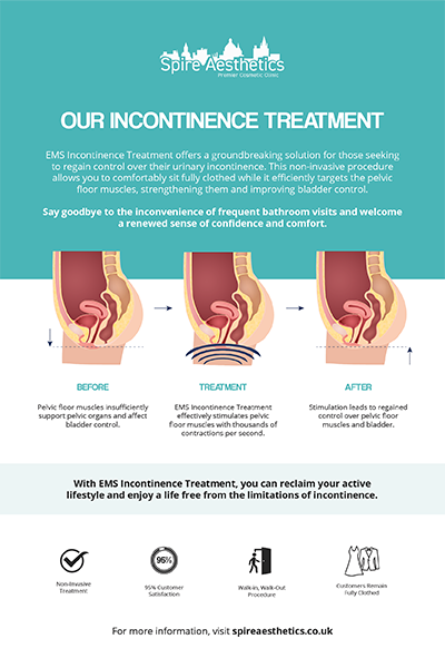 image to show how EMS treatment works for female urinary incontinence Datchet