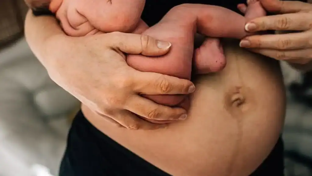 Why Is My Stomach Still Big After Pregnancy Datchet?