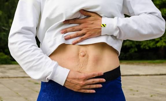 When Could Diastasis Recti Be the Missing Piece of the Puzzle Datchet?